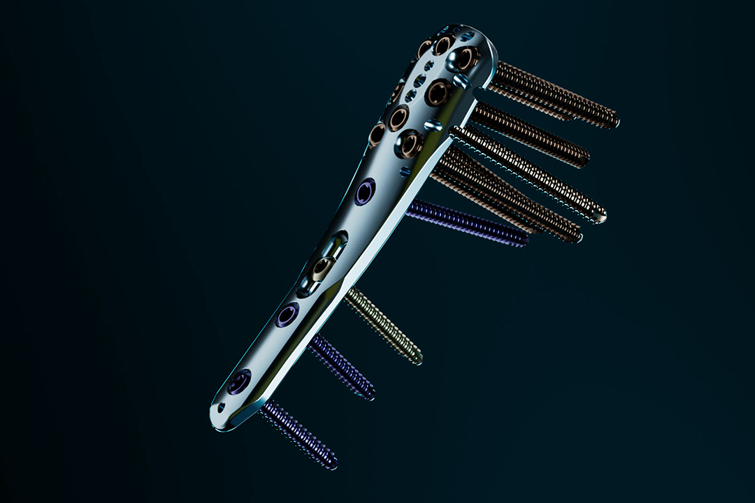 VaWiKo-Humerus2g_02 VaWiKo-Humerus2g_02