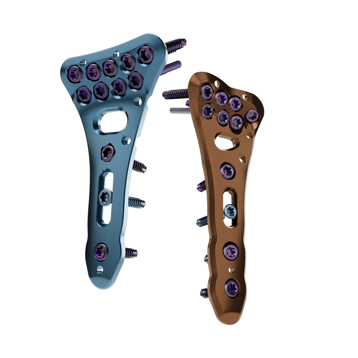 Radius Platte Koenigsee Implantate