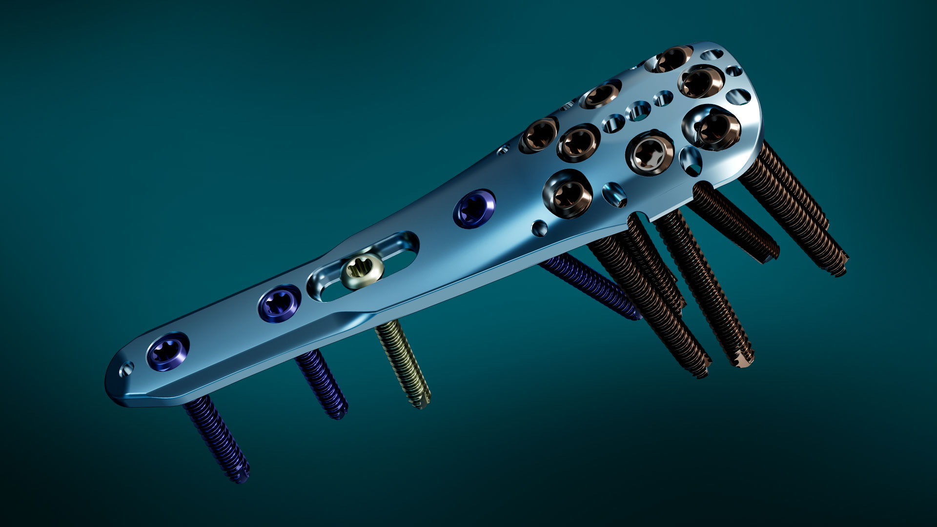 Koenigsee-implantate-Experience-Area-Produkte-Humerus Tibiakopfplatte