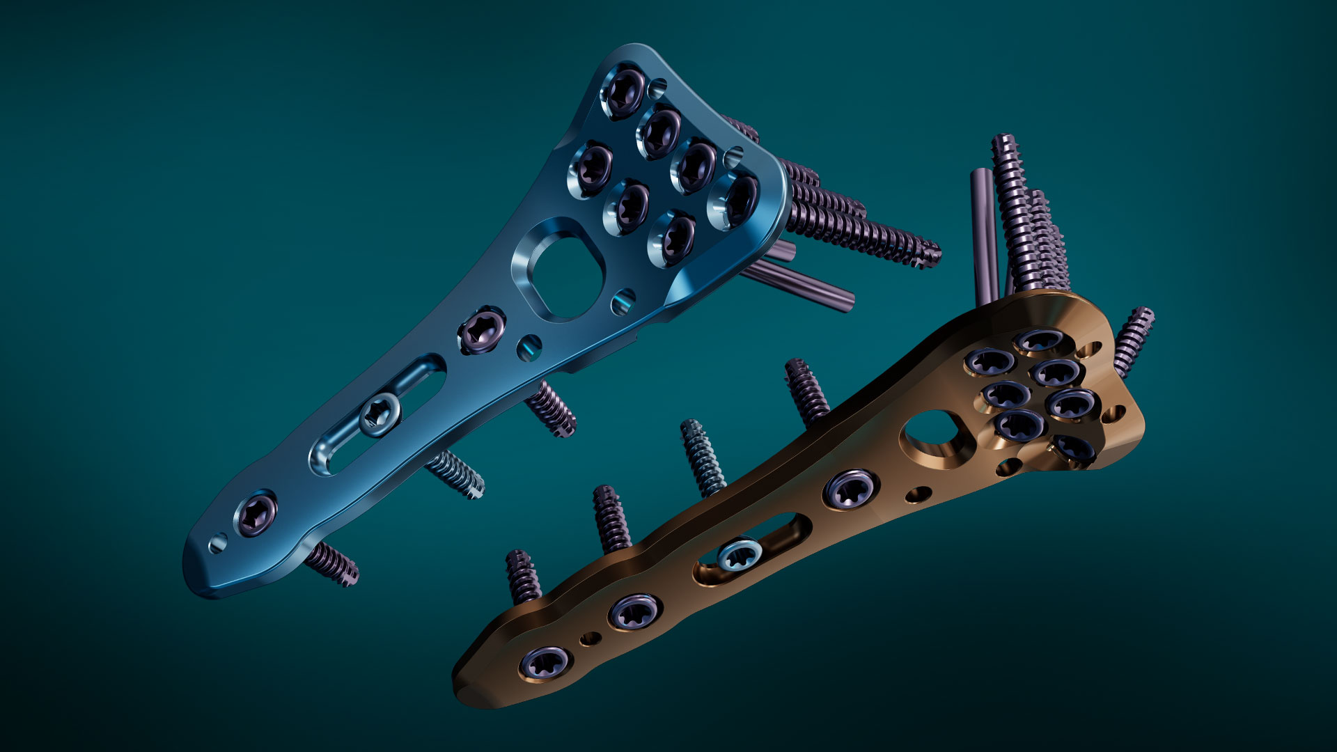 Koenigsee-implantate-Experience-Area-Produkte-Radius Tibiakopfplatte